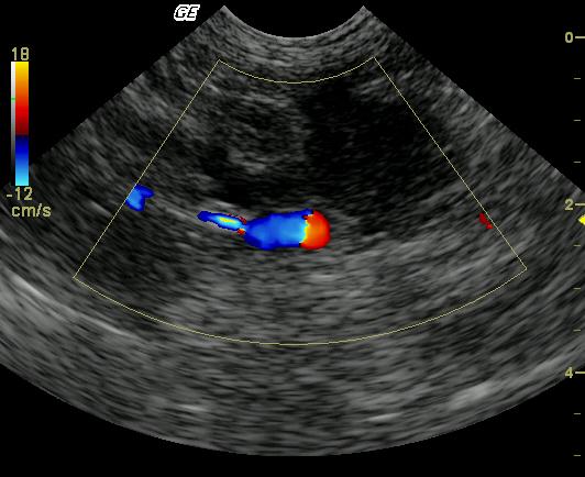 Missy_2_11232009055643