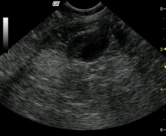 tbone_gi_mass_01202010090237