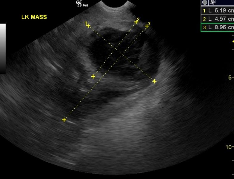 LeftKidneyMass