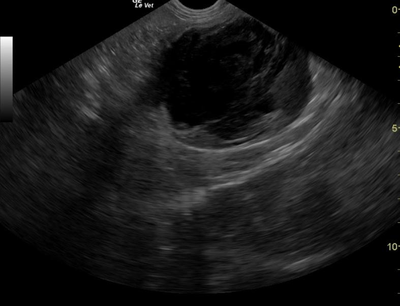 LeftKidneyMass
