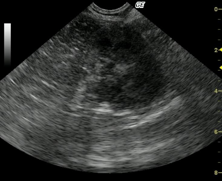 transkidney