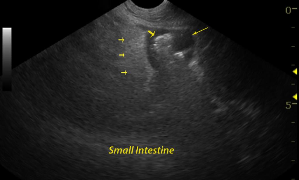 04_00195_ATLAS78MaxCjpg_07282011040104