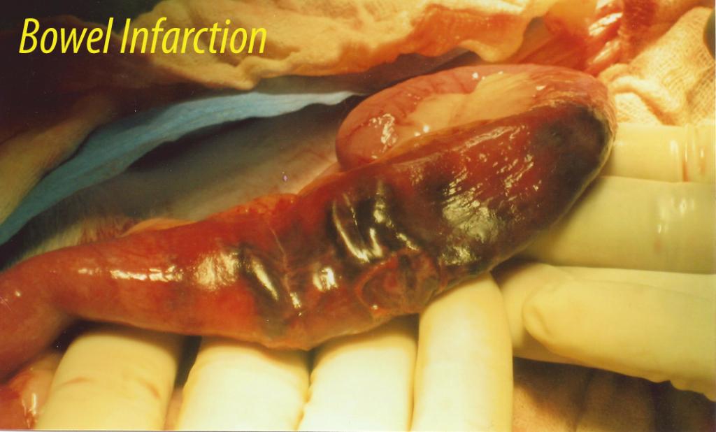 04_00195_ATLAS79MaxCphoto_07282011040112