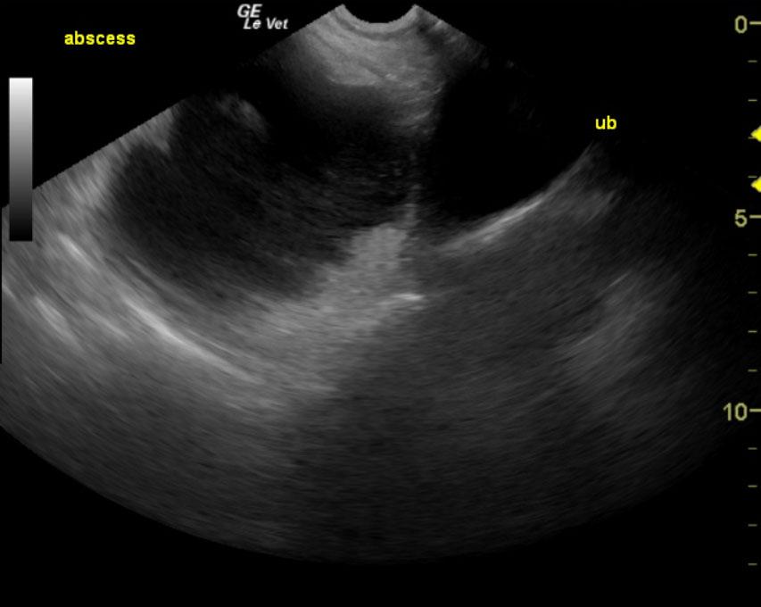 11-00001 Daphne D Abdominal mass omental steatitis-NEEDS SI, SDX- Members
