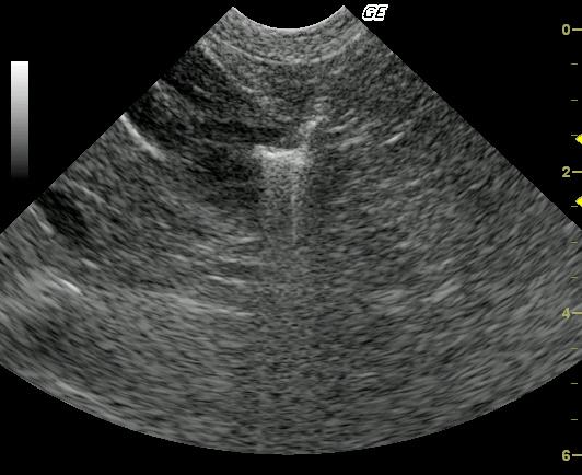 sammy4baytrilinj_08062011091208