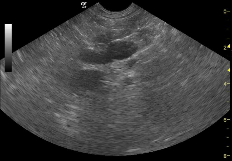 Adrenal_07012012022357