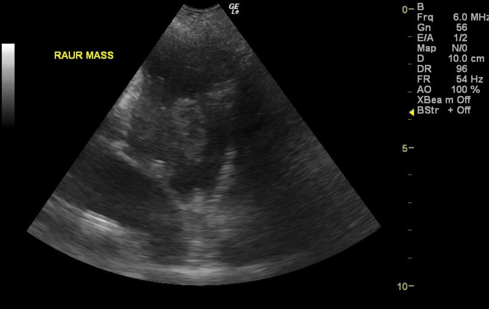 lady_deans_raur_mass_3