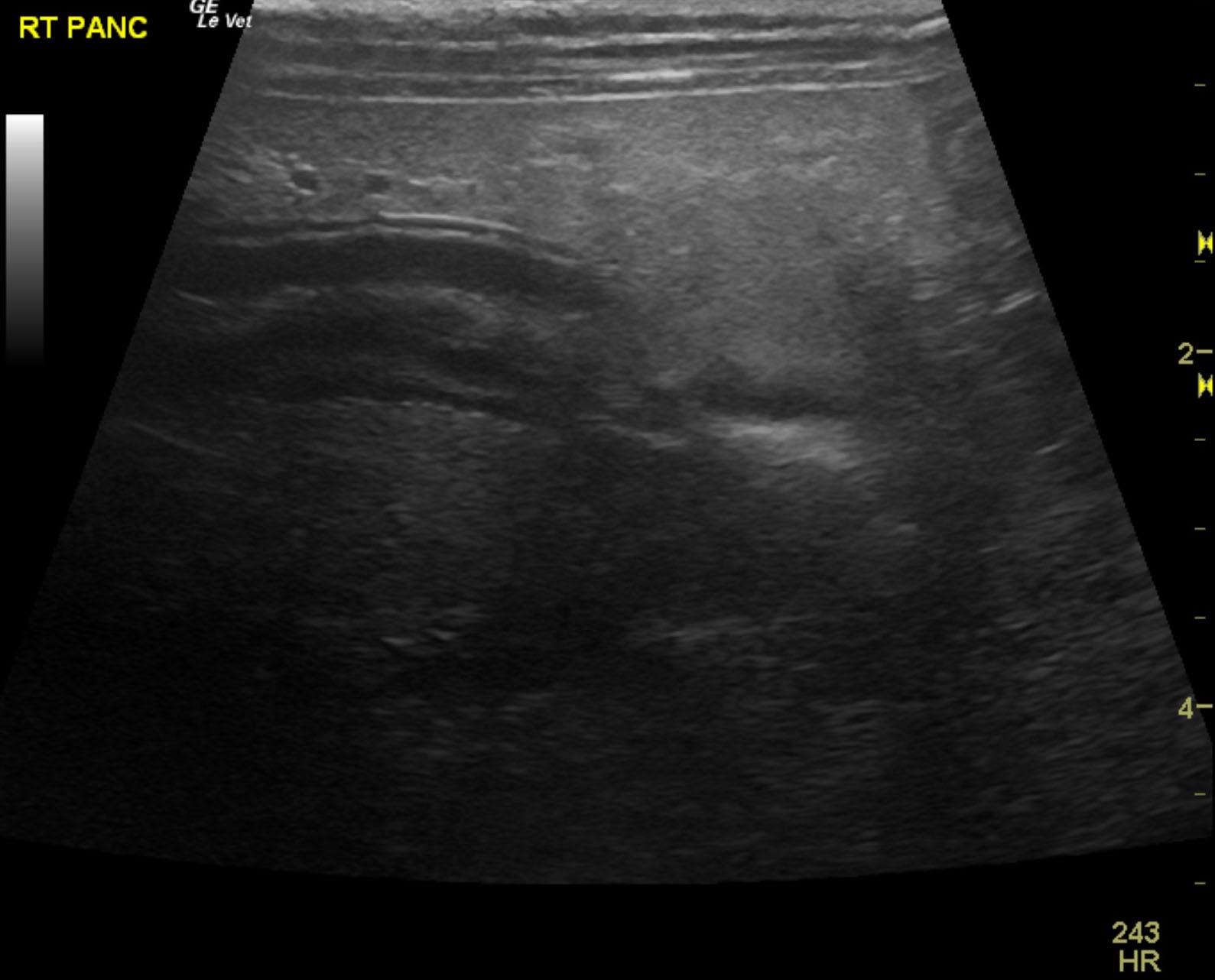 hannah_original_typhlitis_panc_fat