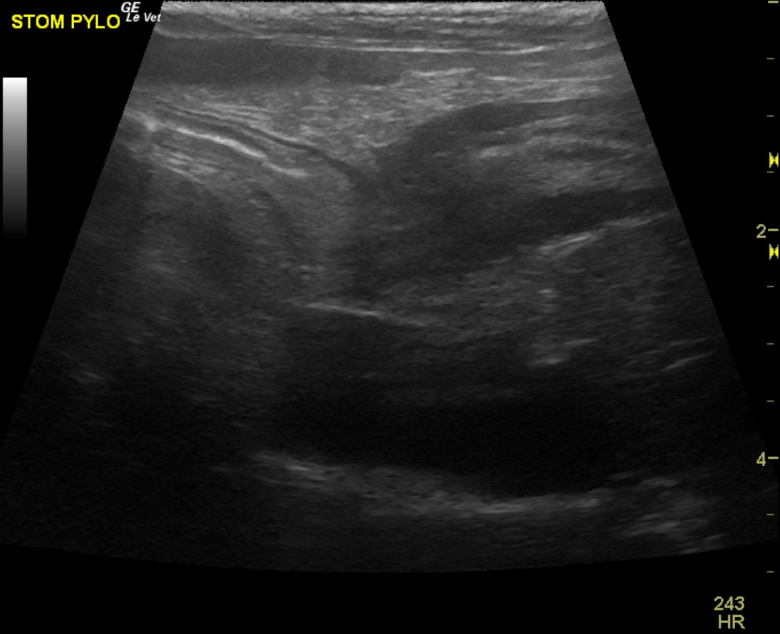 hannah_original_typhlitis_pyl