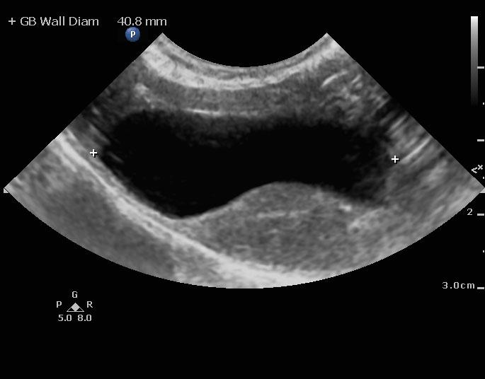 liver_microhepatica_100313_cf_vbvh_frissel_20131003_110230_0011