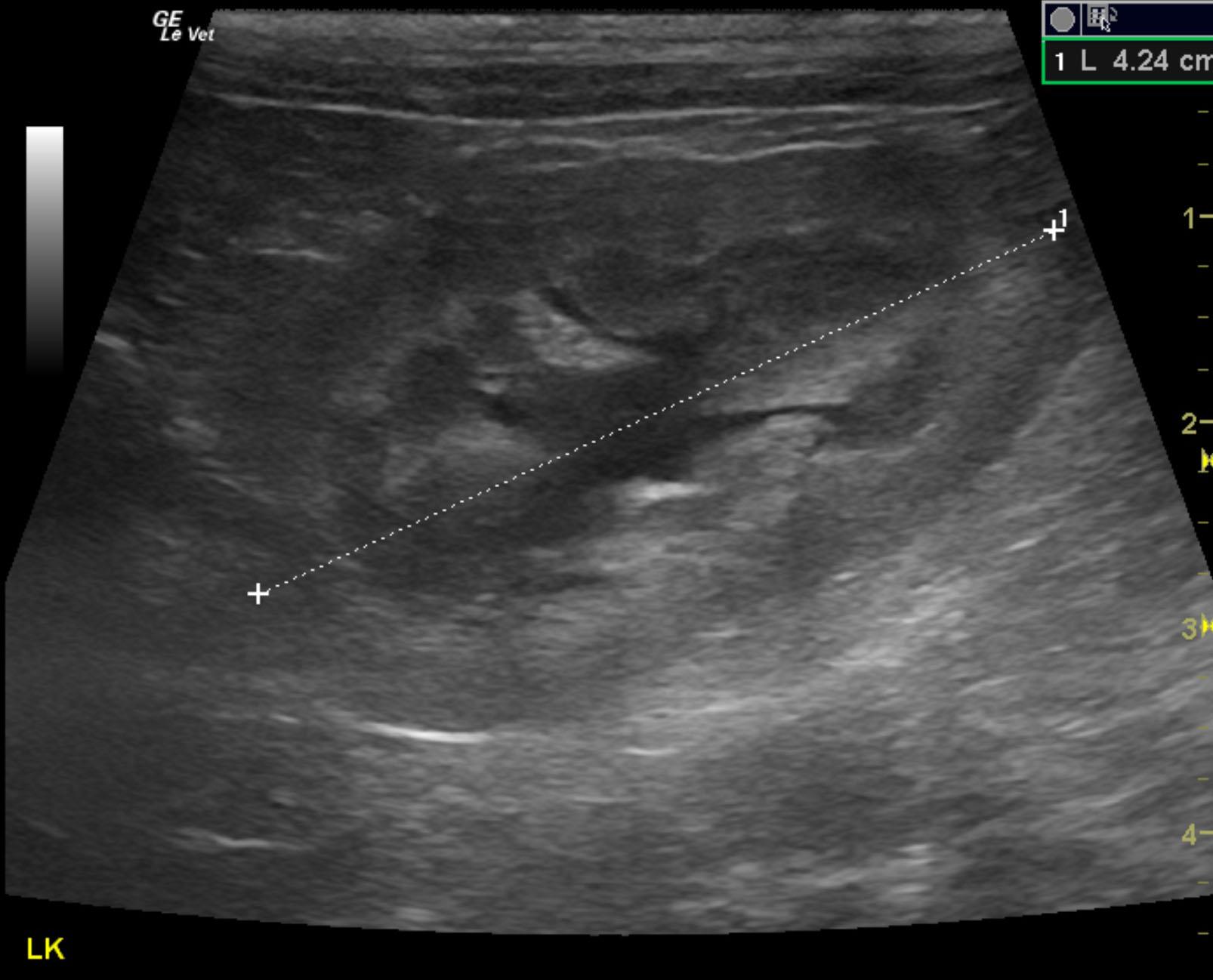 sparky_snider_prostatic_carcinoma_fna_lk_hydro