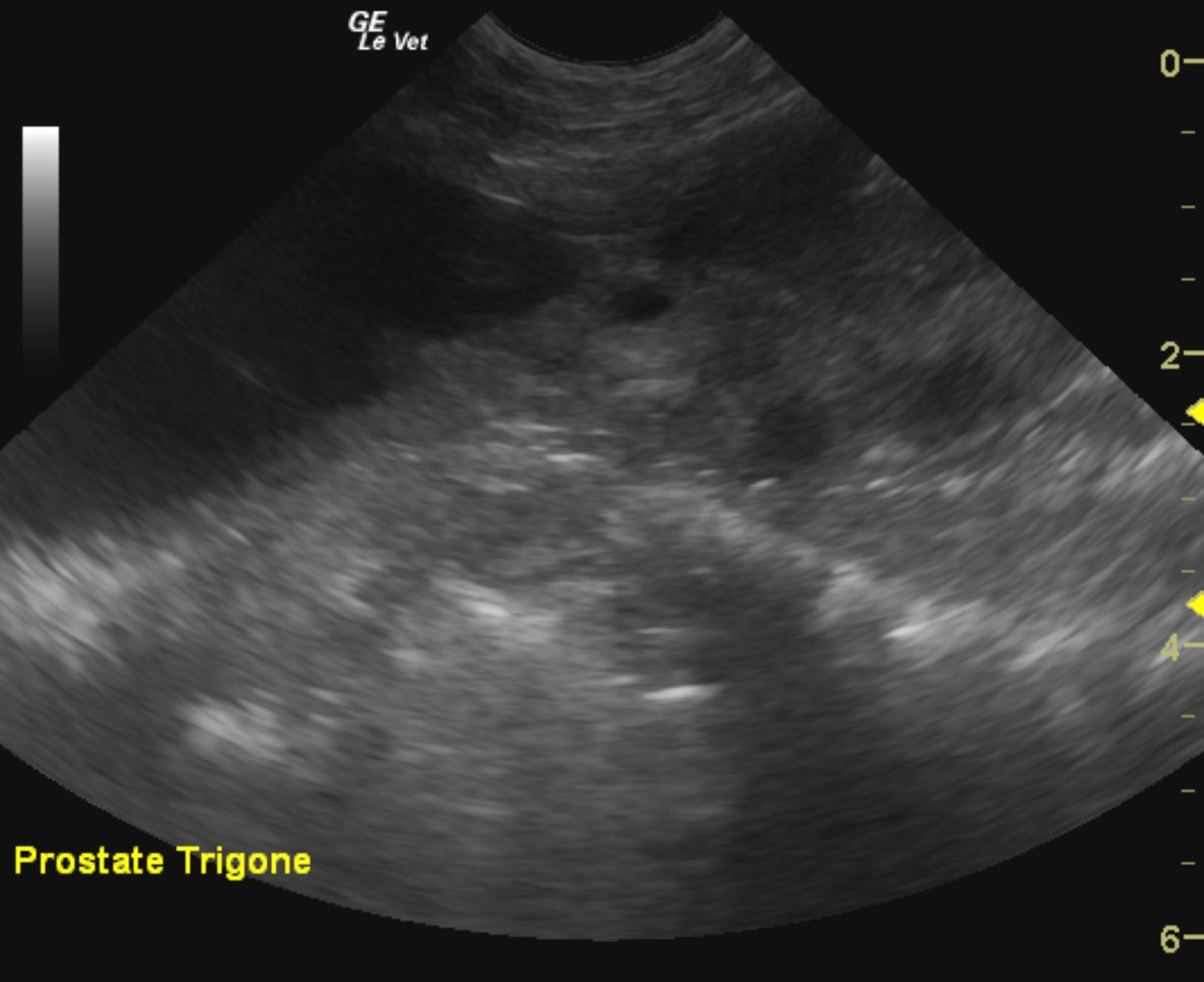 sparky_snider_prostatic_carcinoma_hydroureter_at_trigone