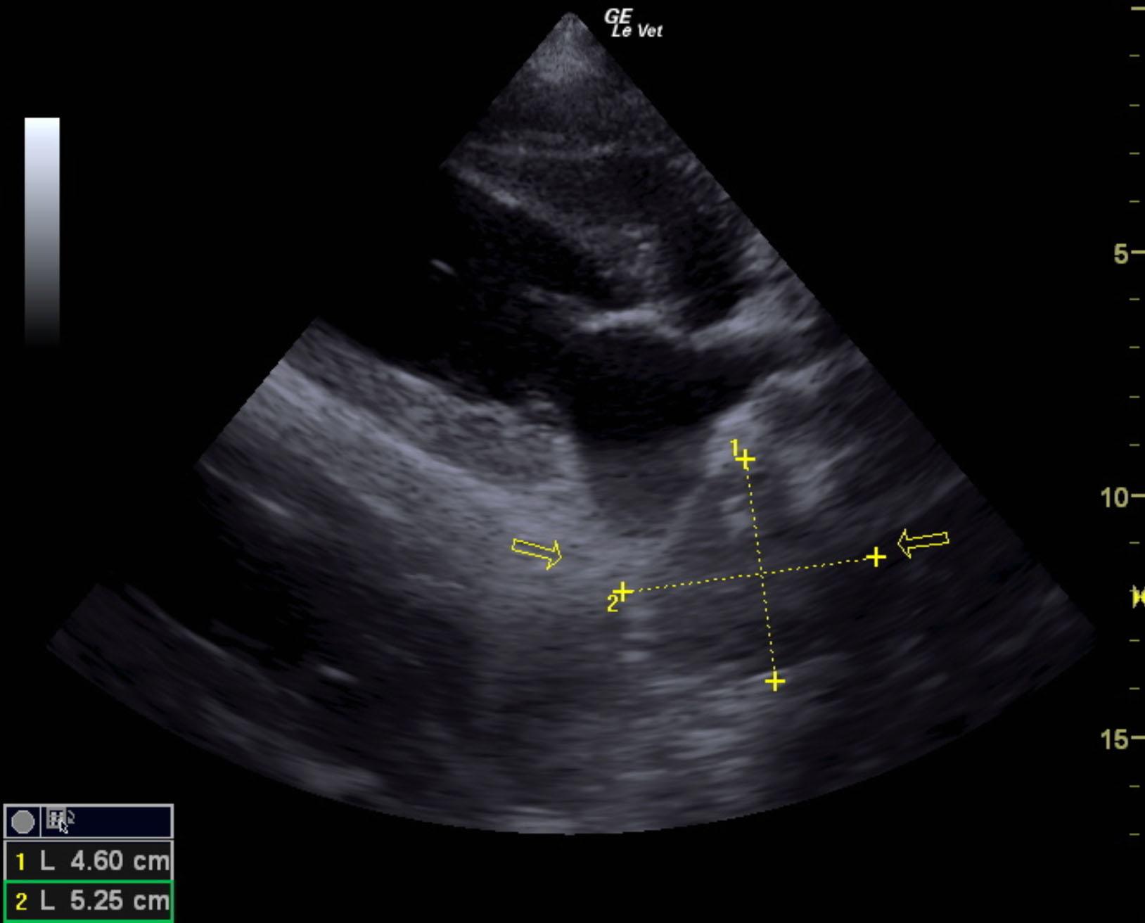 m2m_tom_hanks_heart_based_mass_2