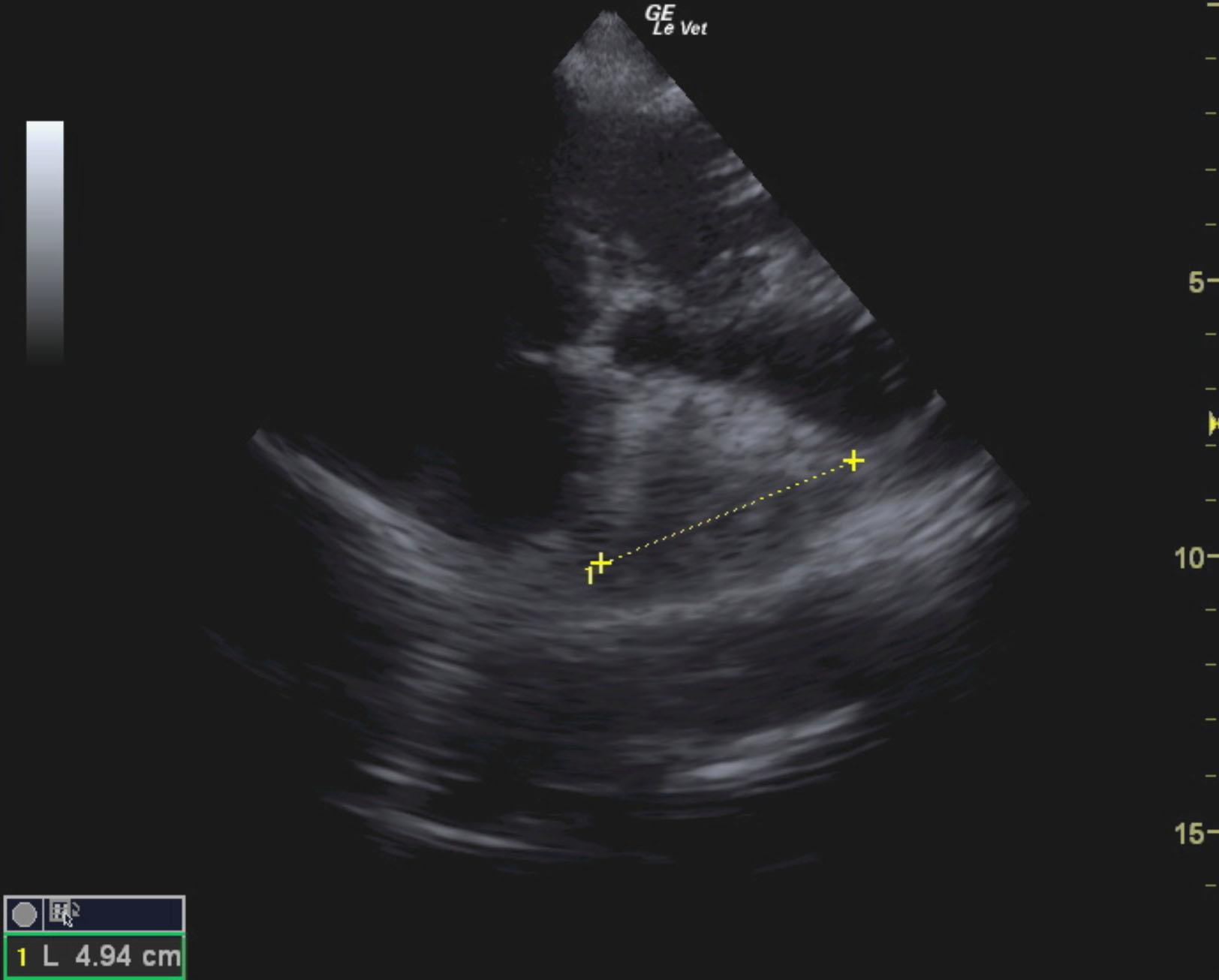 m2m_tom_hanks_heart_based_mass_3