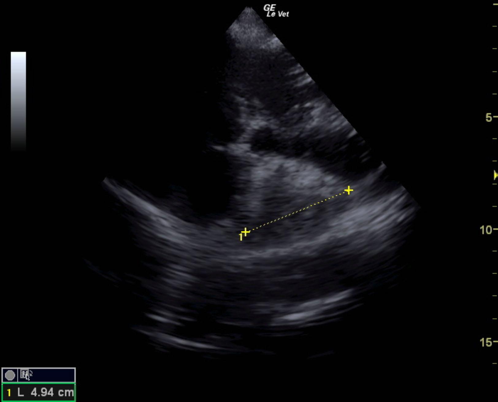m2m_tom_hanks_heart_based_mass