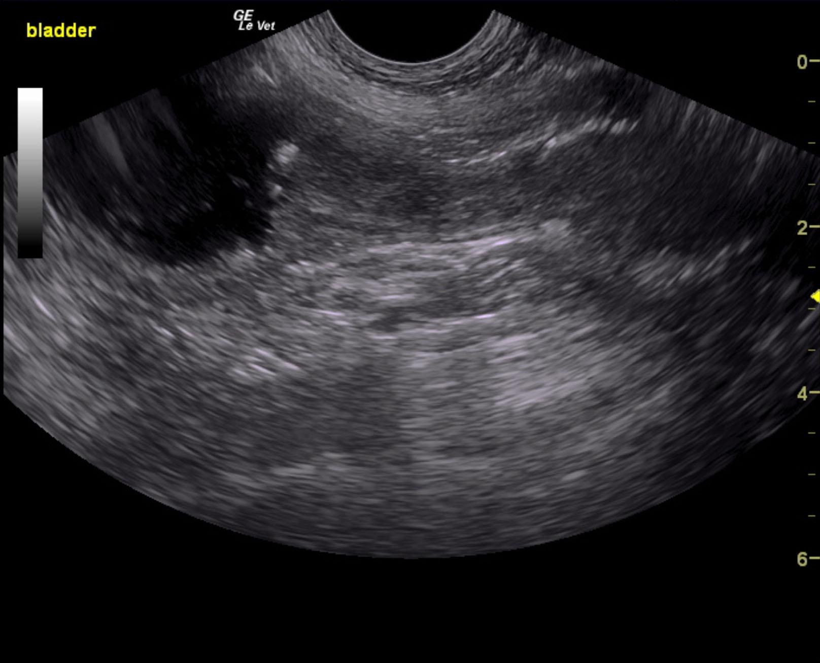 ward_winston_bladder_prostate_carcinoma_