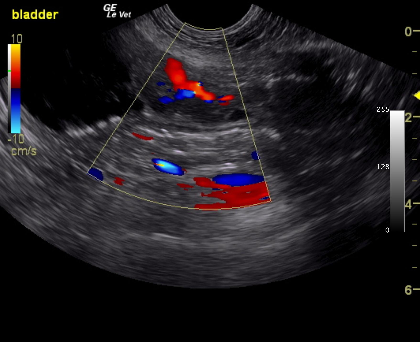 ward_winston_bladder_prostate_carcinoma_cf_urethra