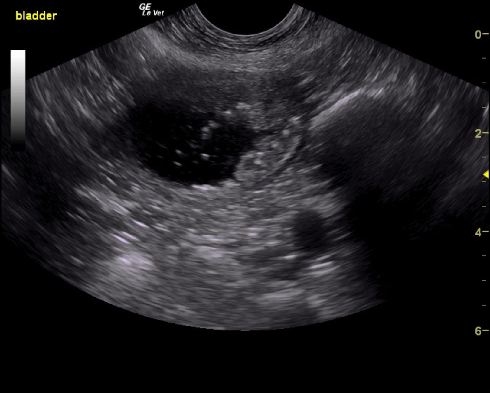 ward_winston_bladder_prostate_carcinoma_2