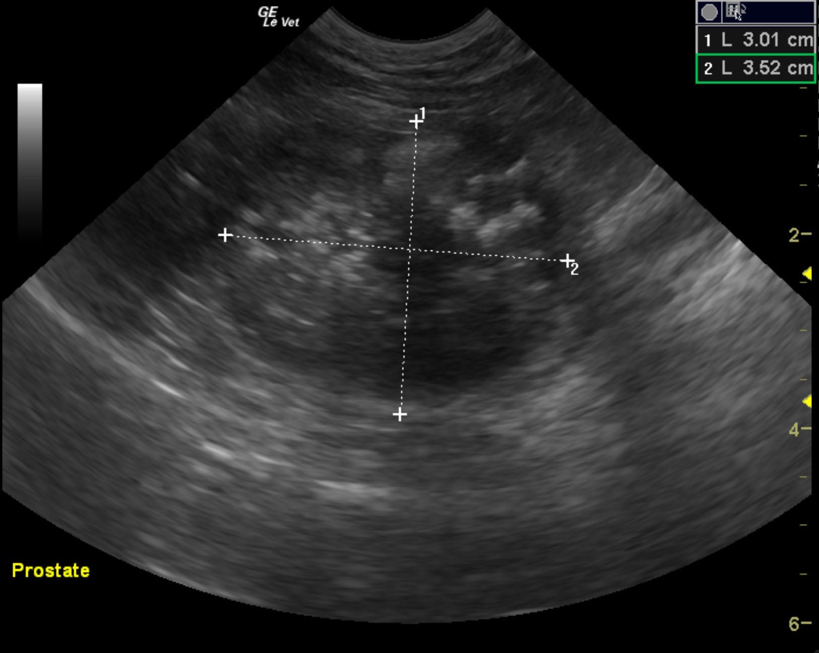 pinot_nordgren_prostatic_carcinoma