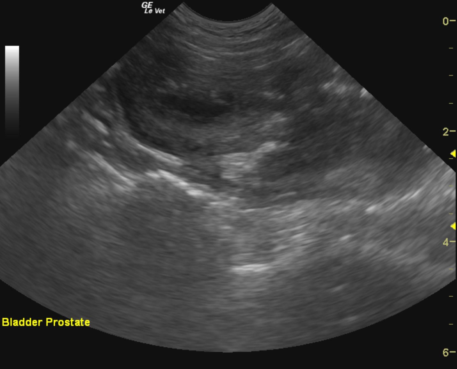 pinot_nordgren_prostatic_carcinoma_ub