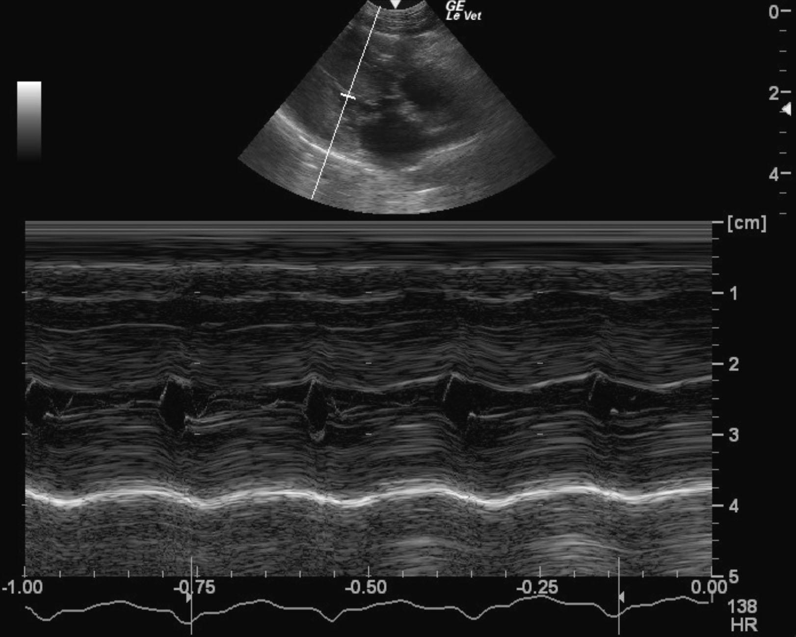 moninger_noodles_hcm_end_stage_lv