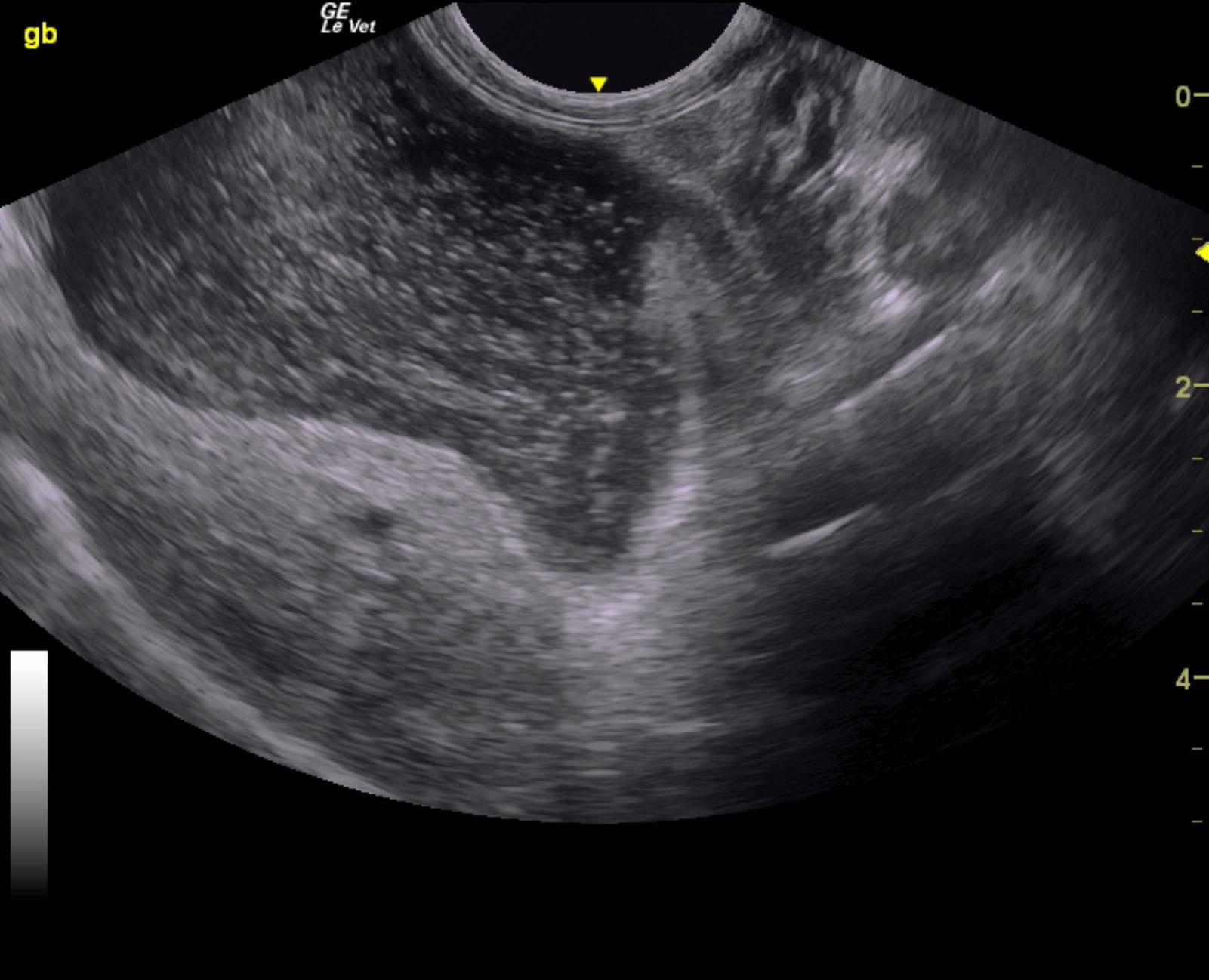 jacobs_sasha_mucoduct_mucocele_2