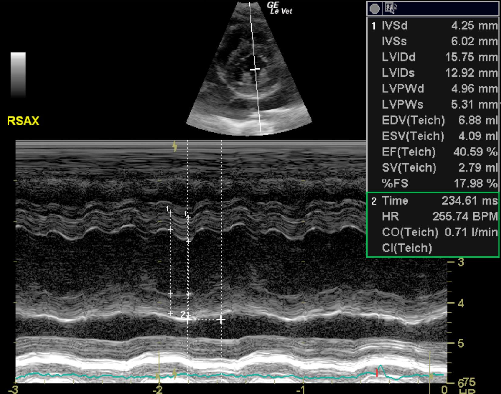 dave_daguiar_echo_rcm_chf_cat_mk_lv_mmode