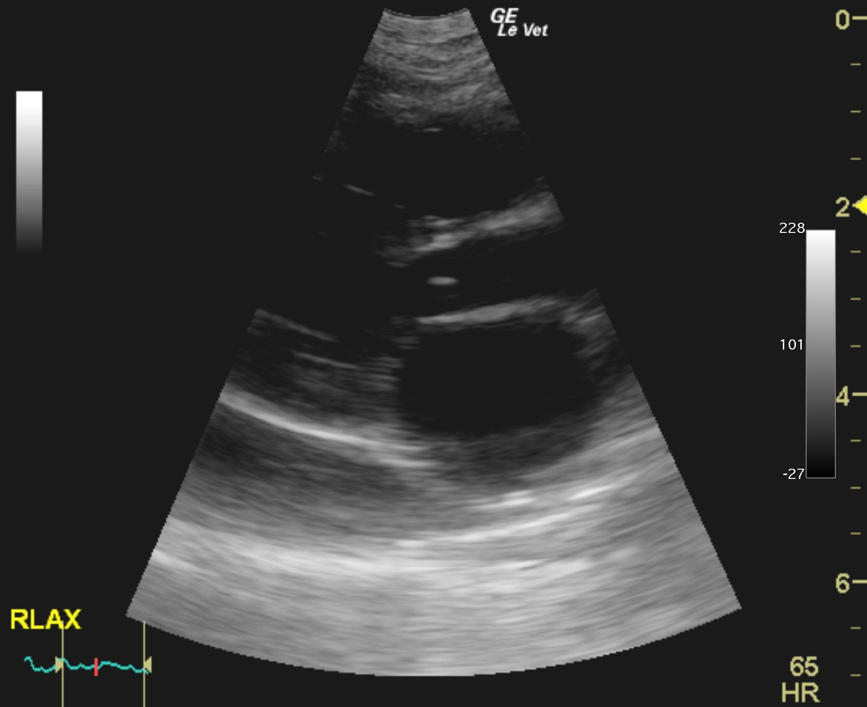 dave_daguiar_echo_rcm_chf_cat_mk_2