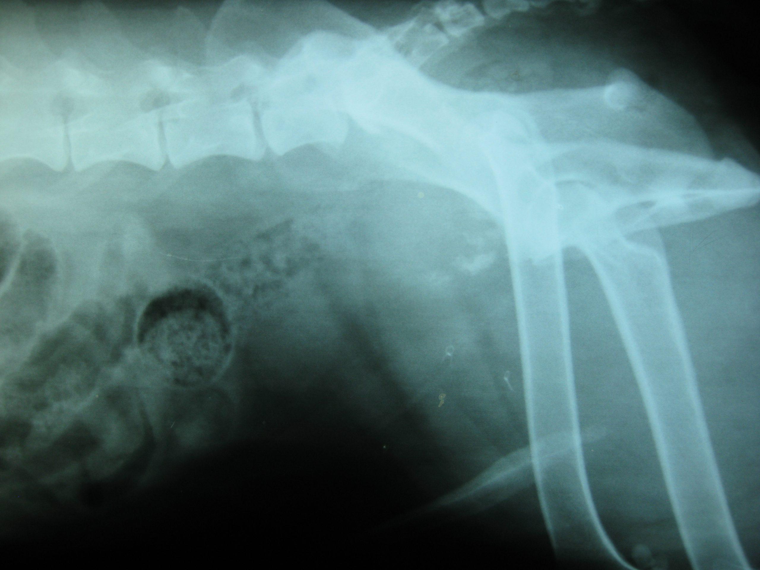 kramer_most_prostate_00000027582