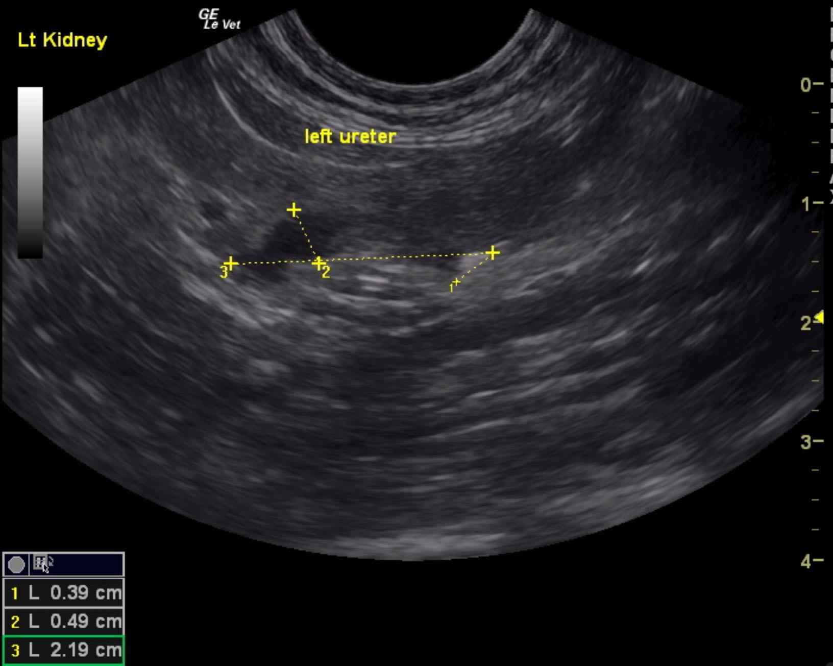 Left ureteral calculus with obstruction in a 4 year old FS DSH cat ...