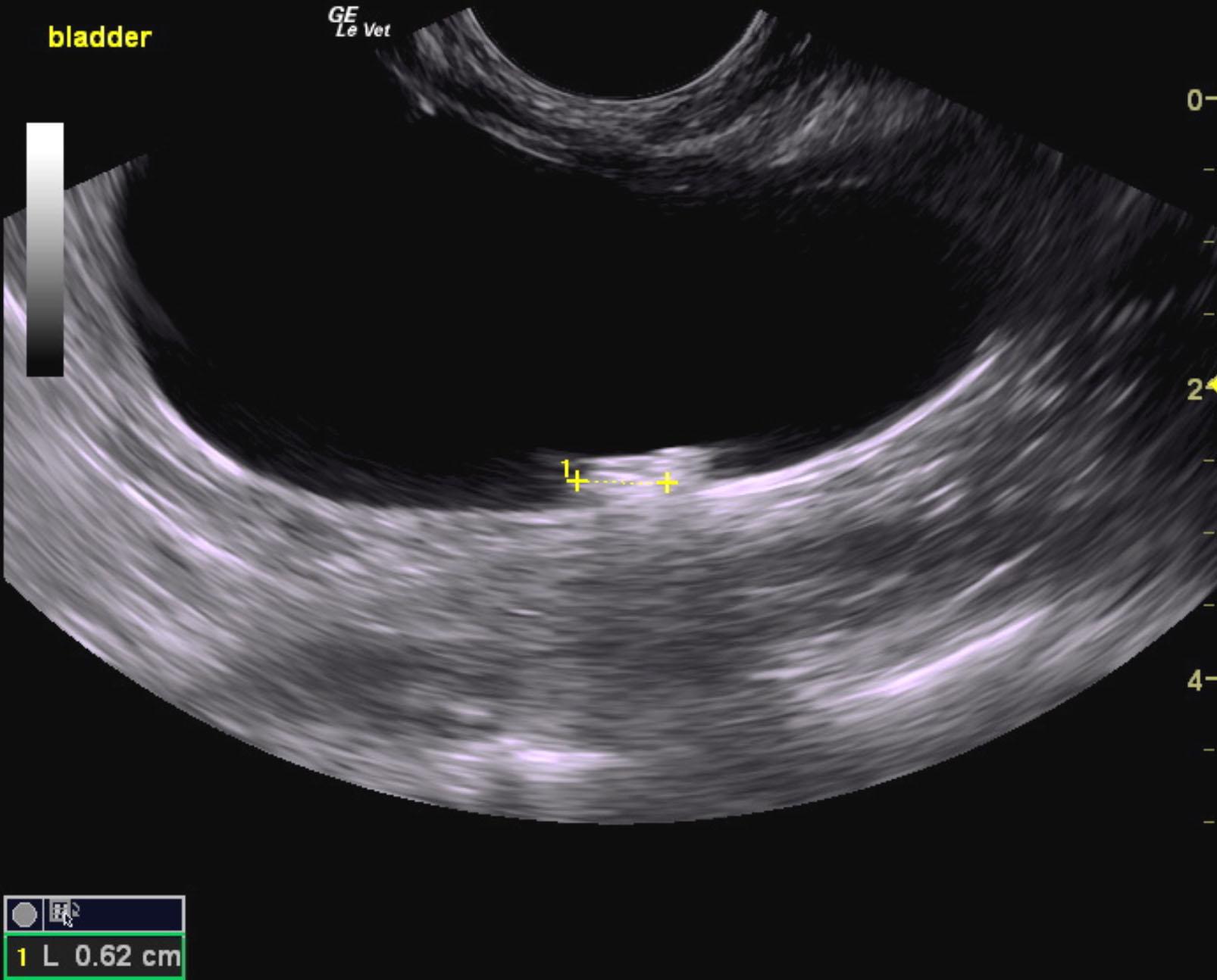 pandora_cushing_renal_stone_passage_renal_failure_ub_stones