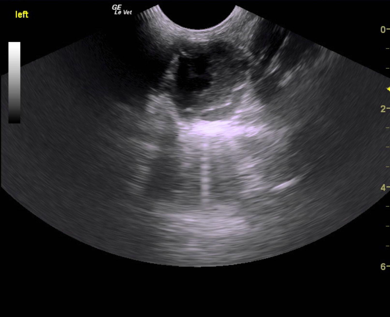 grady_krebs_uveitis_retinal_detachment_gluacoma_on_left_eye
