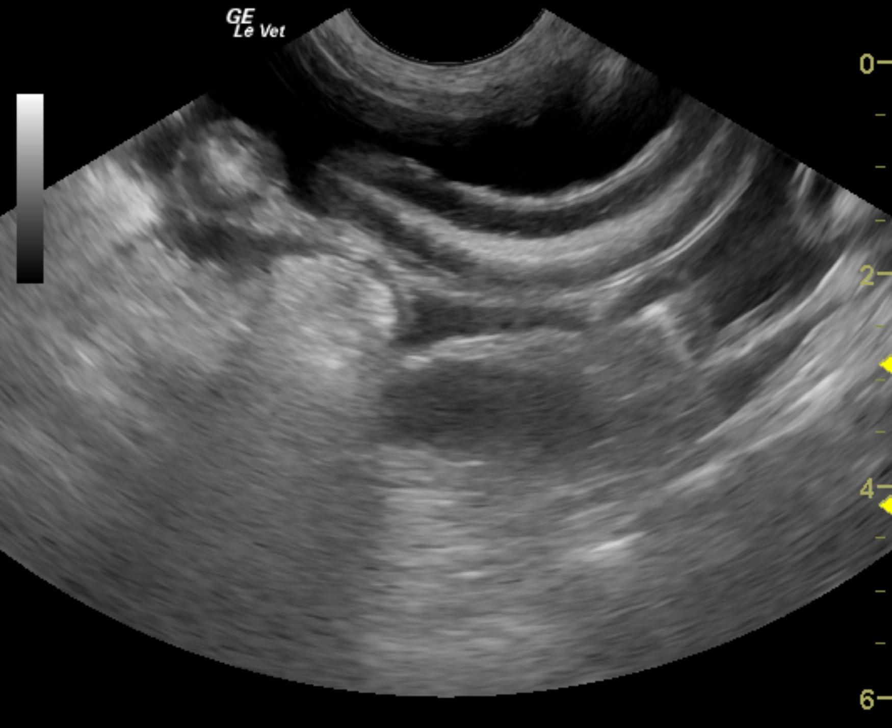 harley_kirwin_cvc_thrombus_5_11_11_normal_intestine_ascites_2